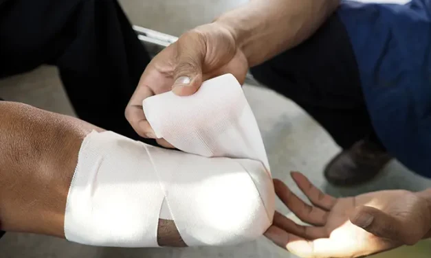 Tindakan Medis Dalam Melakukan Amputasi Pada Anggota Tubuh